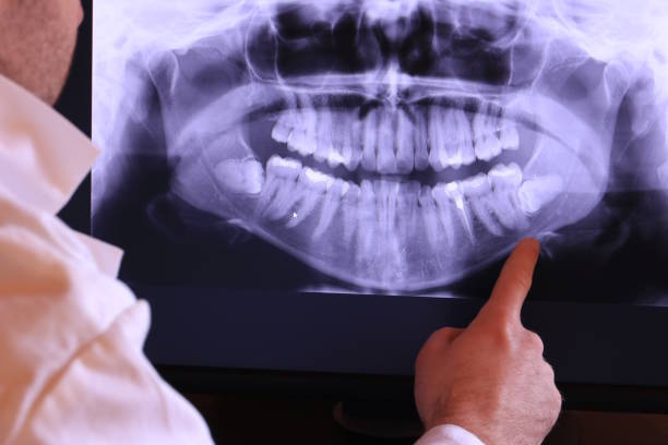 Best Urgent Care for Lost Fillings or Crowns in Fairview, OK