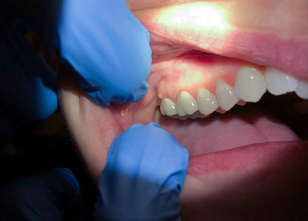 Best Pediatric Emergency Dentist in Fairview, OK